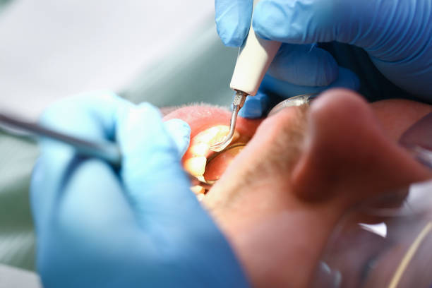 Best Knocked-Out Tooth Emergency  in Standish, MI